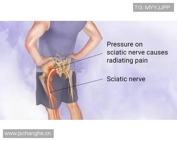 专家解读坐骨神经痛成因及治疗方法大多数患者可避免手术治疗